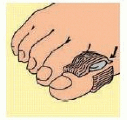 Digital Pads Cusc Digit S/m