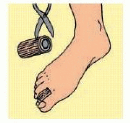 Digi-strip Tubolare C/gel M